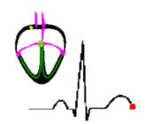 ECG signal